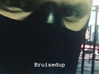 Bruisedup